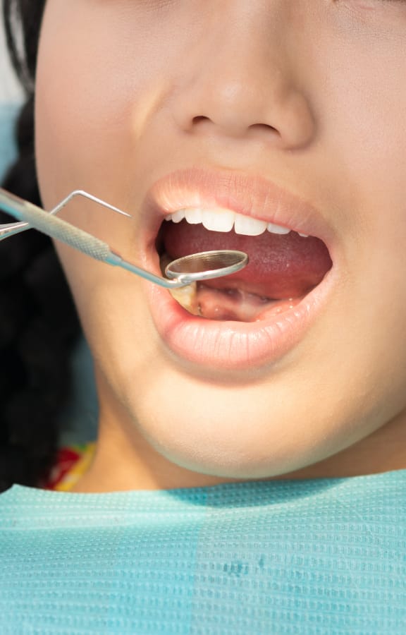 Close up of dental tools in a girls mouth