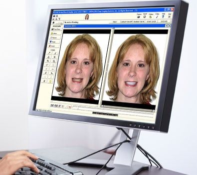 SNAP Cosmetic Imaging