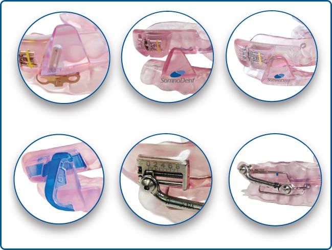 SomnoDent Appliance